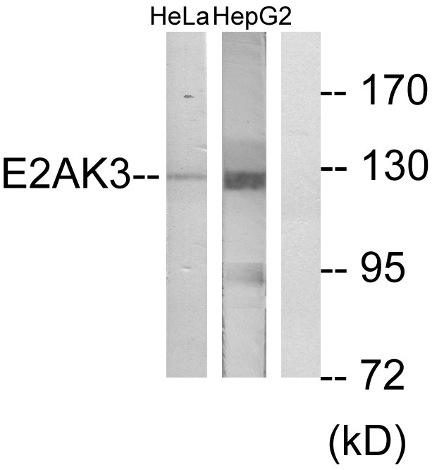 PERK Ab