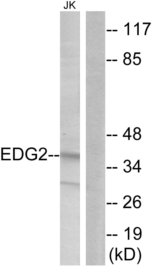 LPA receptor 1 Ab