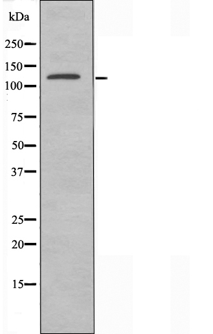 ERCC5 Ab