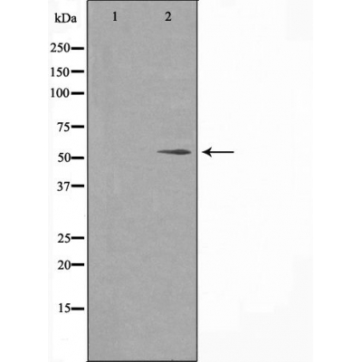 FOXC1/2 Ab