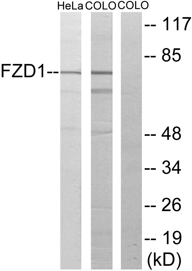 Frizzled 1 Ab