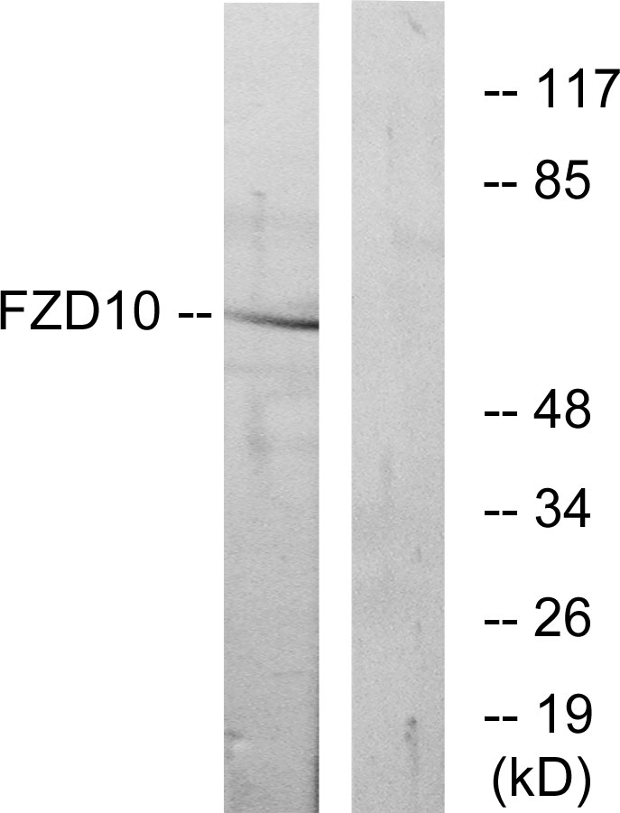 Frizzled 10 Ab