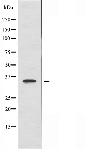 gamma Glutamyl hydrolase Ab