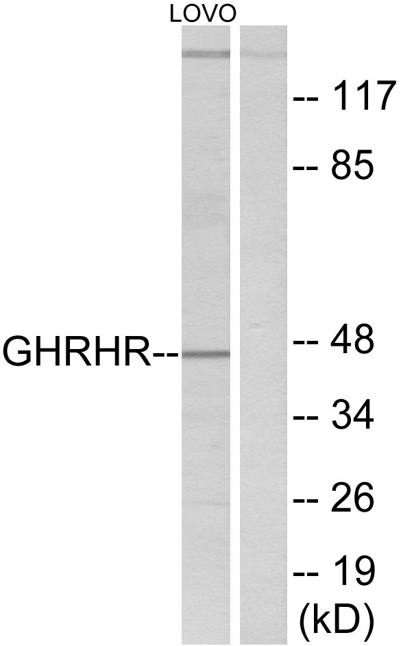 GHRH receptor Ab