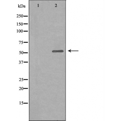 Glucagon receptor Ab