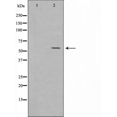 Glucosidase 2 beta Ab