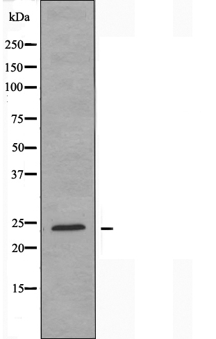 GSC 2 Ab