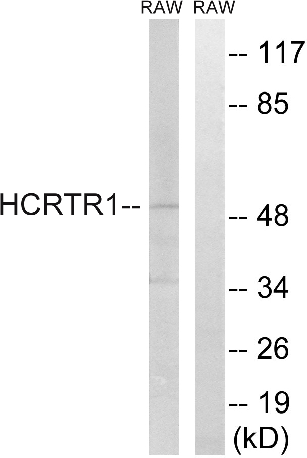 Orexin receptor type 1 Ab