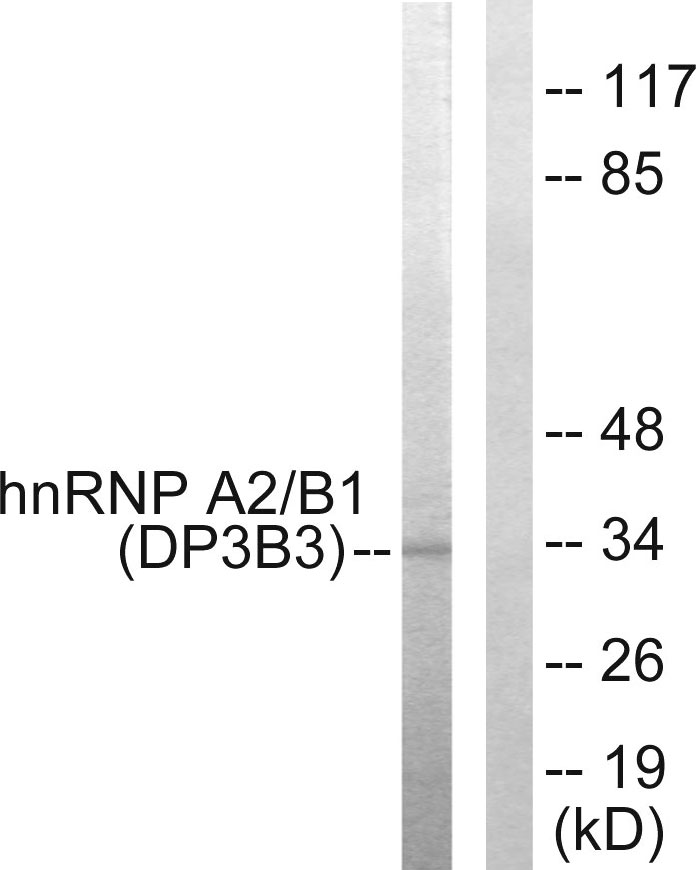 hnRNP A2/B1 Ab