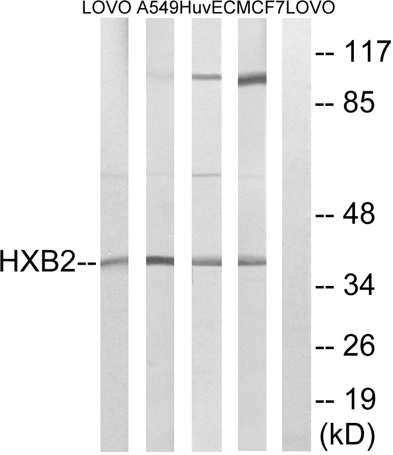 HOX B2 Ab