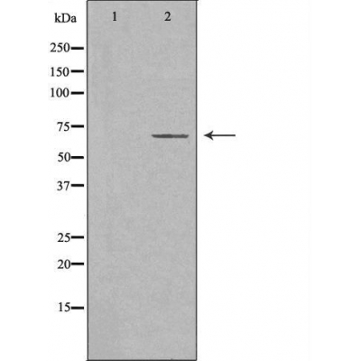 IL 18 receptor 1 Ab