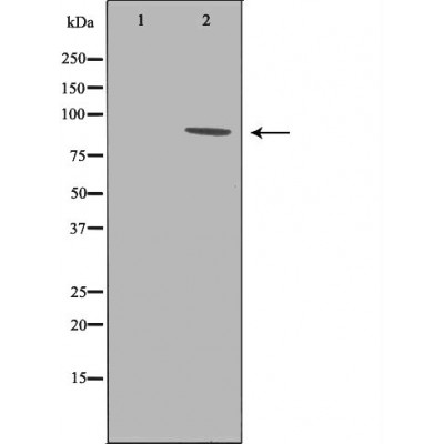 Integrin beta 3 Ab