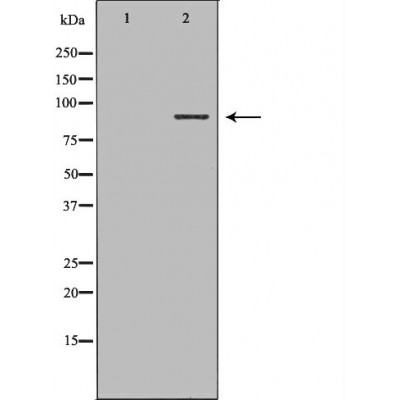 Integrin beta 5 Ab