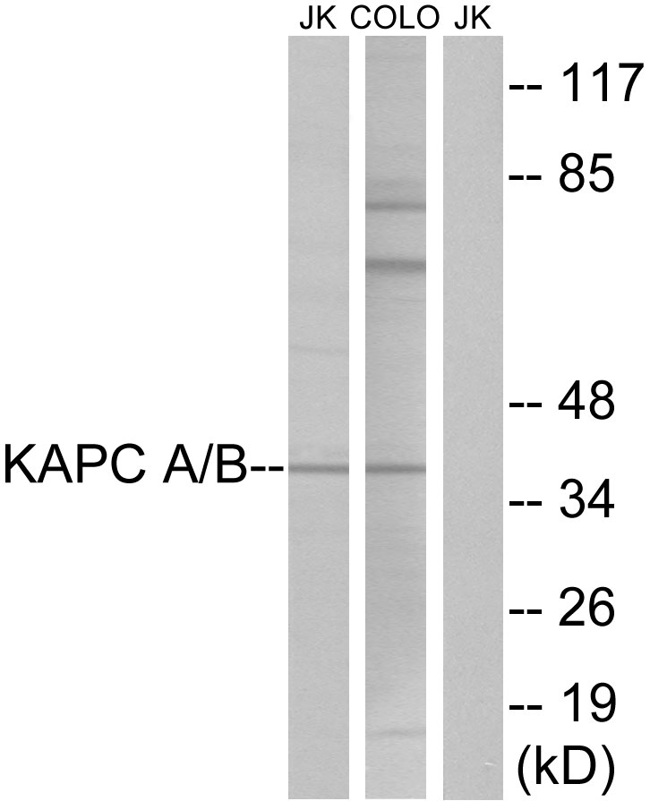 PKC alpha/beta Ab