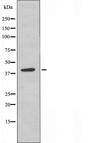 PKA C gamma Ab