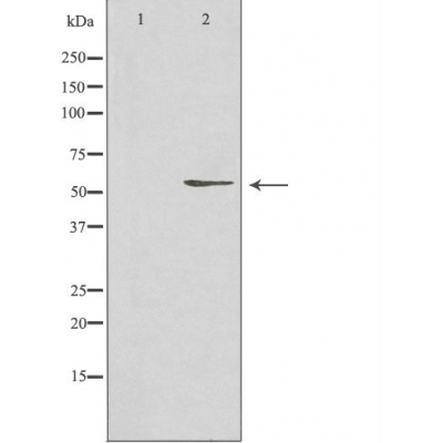 KLF11 Ab