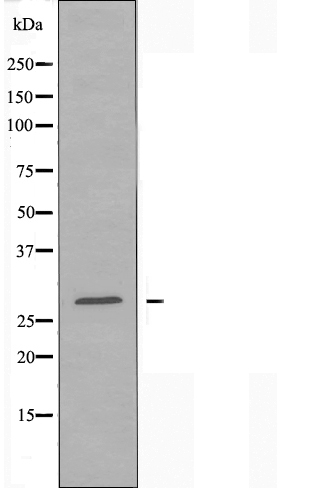 KLRC1 Ab