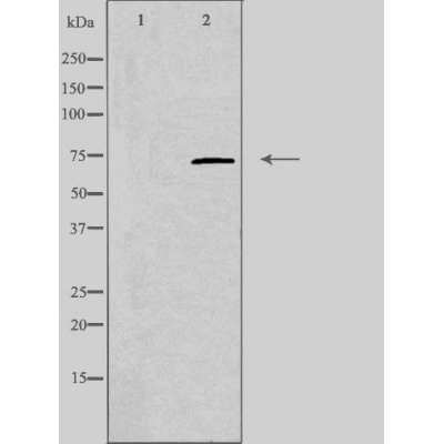 Kinetochore protein NDC80 homolog Ab