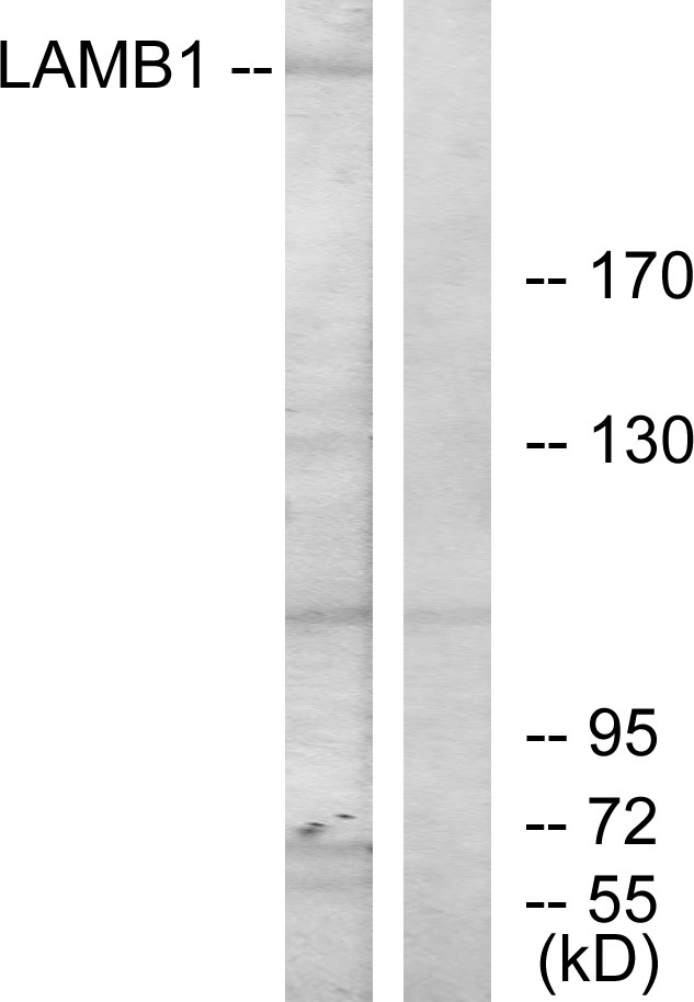 Laminin beta 1 Ab