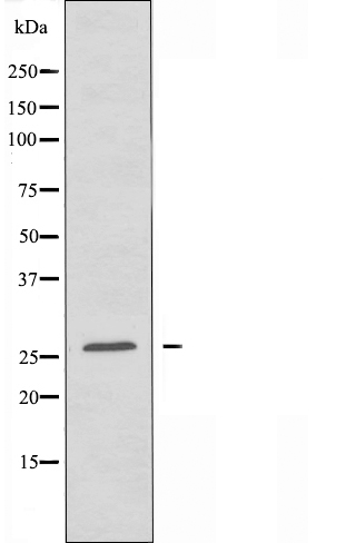 LDLRAD1 Ab