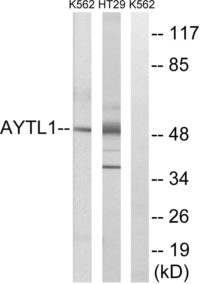 LPC acyltransferase 2 Ab