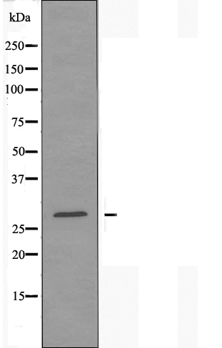 Mannose binding lectin Ab