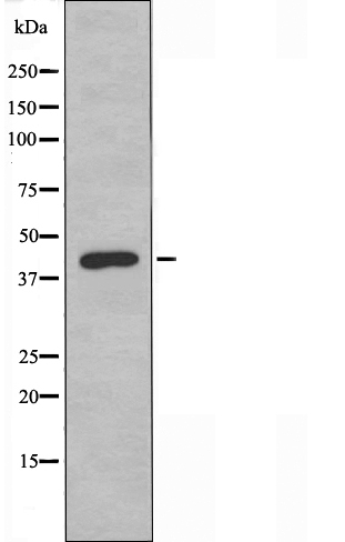 Creatine kinase M type Ab