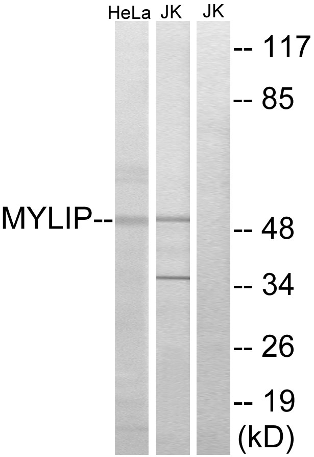 MYLIP Ab