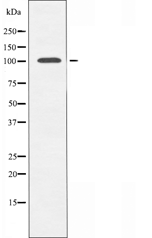 N4BP1 Ab