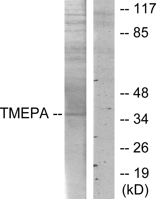 TMEPAI Ab