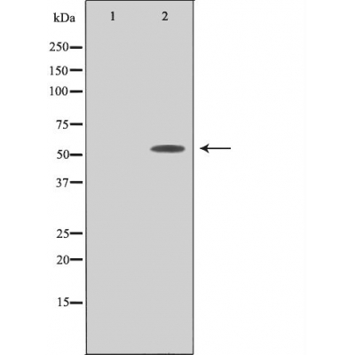 Periphilin 1 Ab