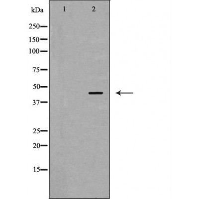 PSMC6 Ab