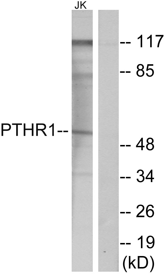 PTH1R Ab