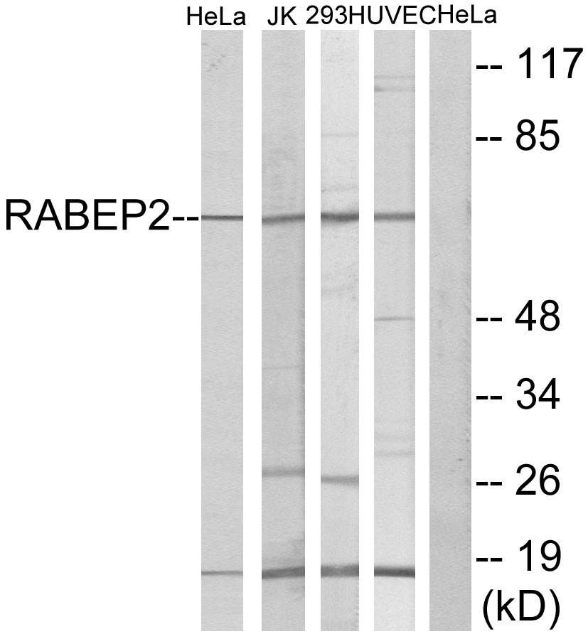 RabEP2 Ab