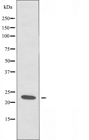 Calcipressin 1 Ab