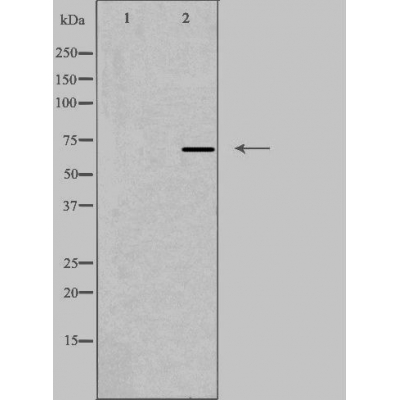 Radixin Ab