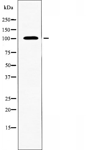 ARHGAP17 Ab