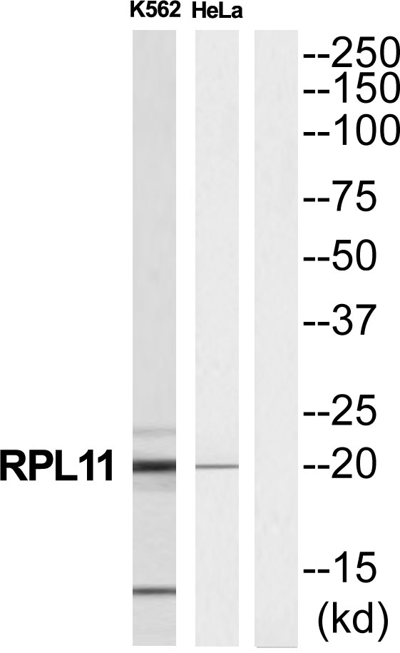 RPL11 Ab