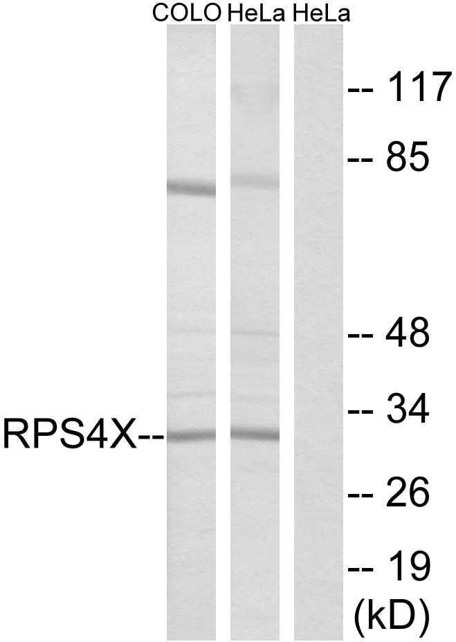 RPS4X Ab