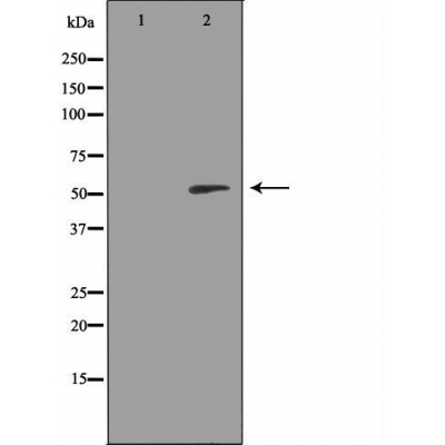 RSAD1 Ab