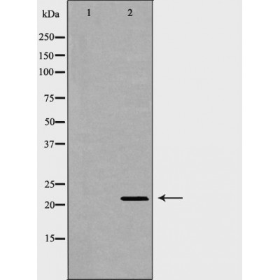 Syndecan 2 Ab