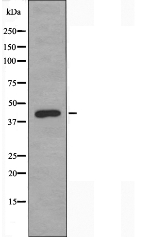 Septin 2 Ab