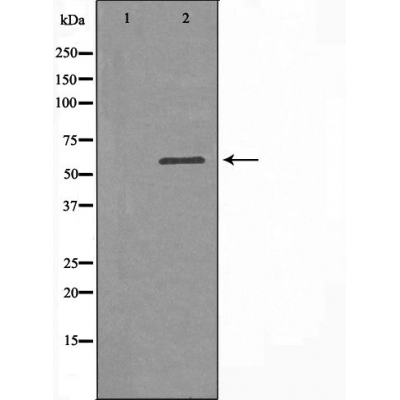 MCT 8 Ab