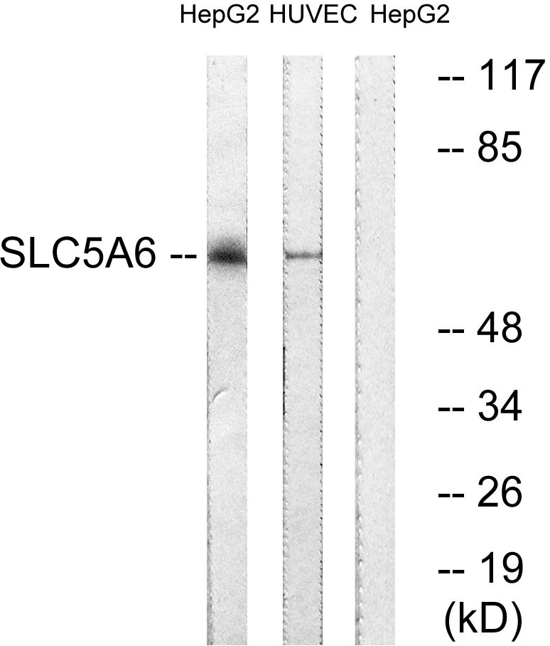 SLC5A6 Ab