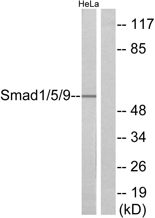 SMAD1/5/9 Ab