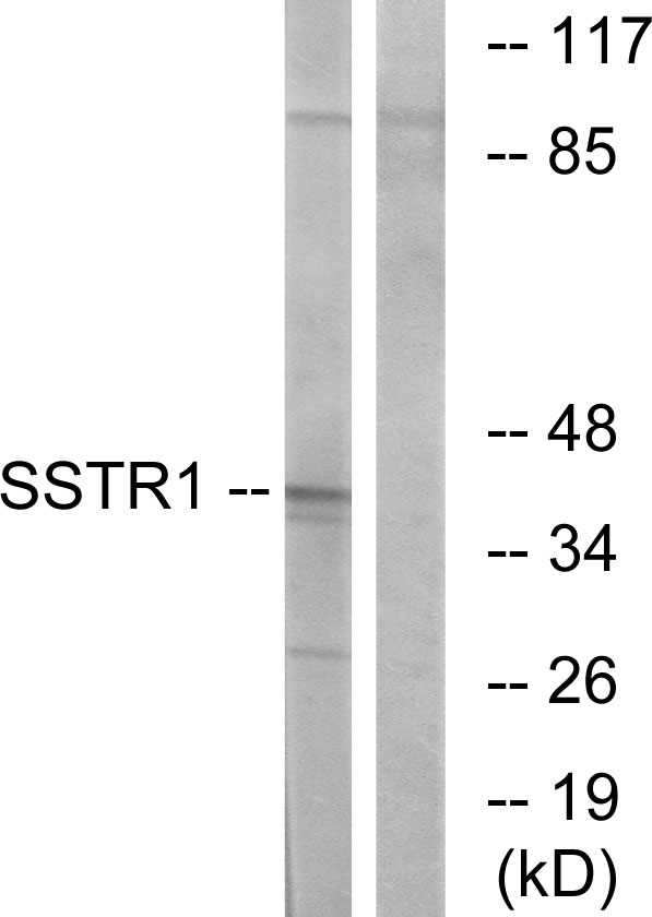 SSTR1 Ab