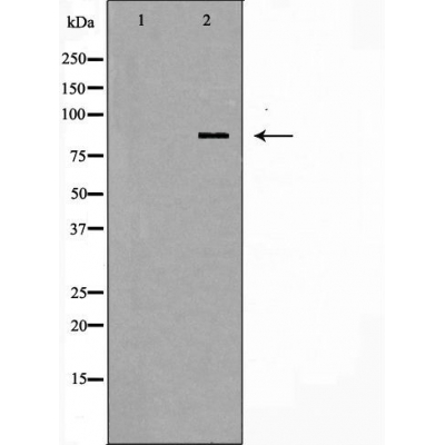 STAT1 Ab