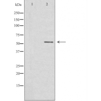 STK32C Ab