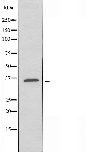 Thyrotroph embryonic factor Ab