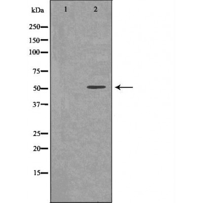 Thyroid hormone receptor beta Ab